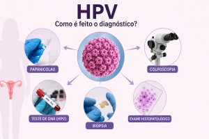 Diagnóstico do HPV com Papanicolau, colposcopia, teste de DNA e biópsia